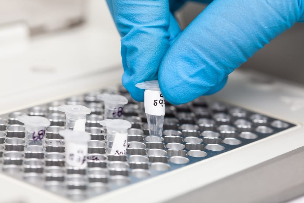 Kỹ thuật viên sử dụng dung môi DMSO trong phản ứng PCR tại phòng thí nghiệm công nghệ sinh học