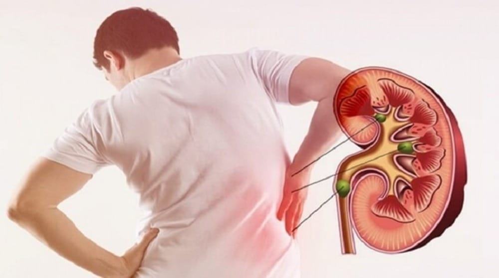 Chất độc hại có thể gây ung thư